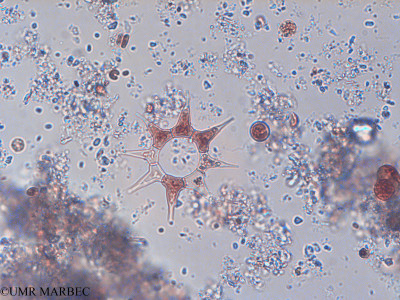 phyto/Pertuis Charentais/Tasdon_st2/PAMPAS 2019-2021/Monactinus simplex (TASDON_St2_140319-098).tif(copy)_thumb.jpg